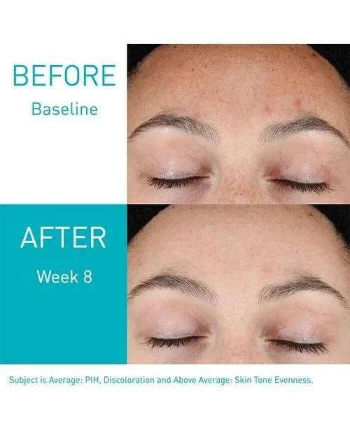 CeraVe Resurfacing Retinol 𝐒𝐞𝐫𝐮𝐦