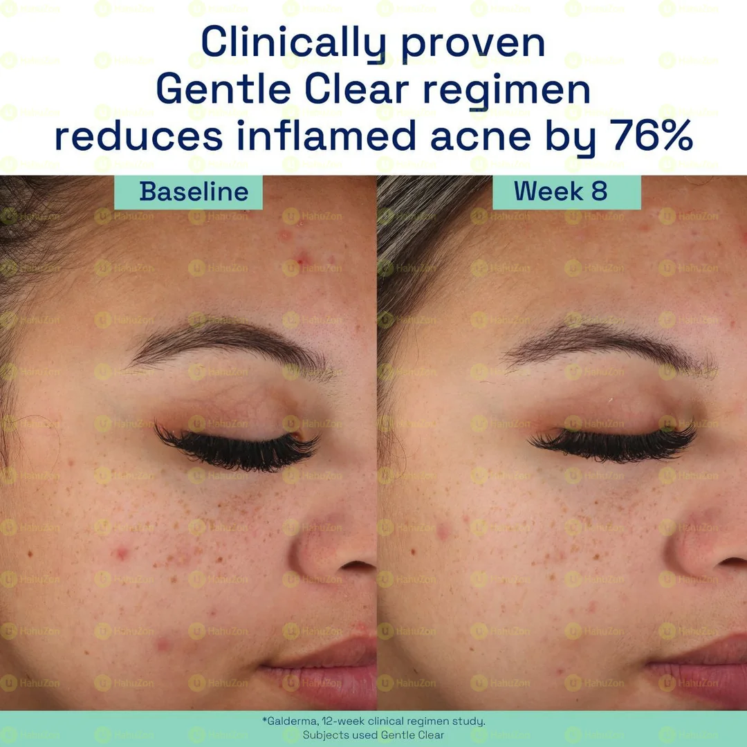 Cetaphil Gentle Clear Mattifying Acne Moisturizer