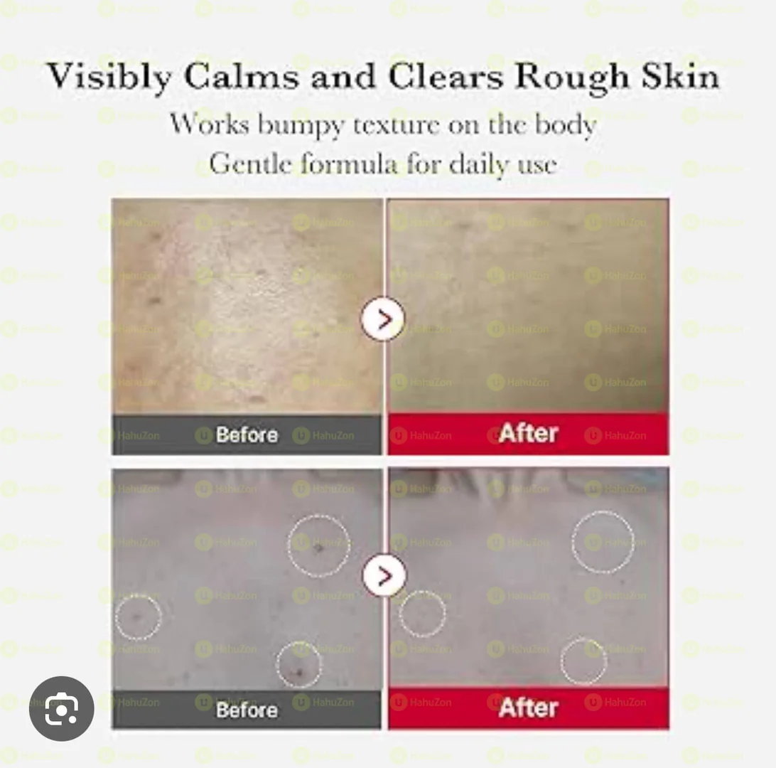 Medicube Red Acne Body Peeling
