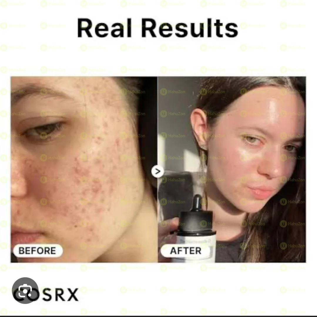 Galactomyces 95 Tone  Balancing Essence