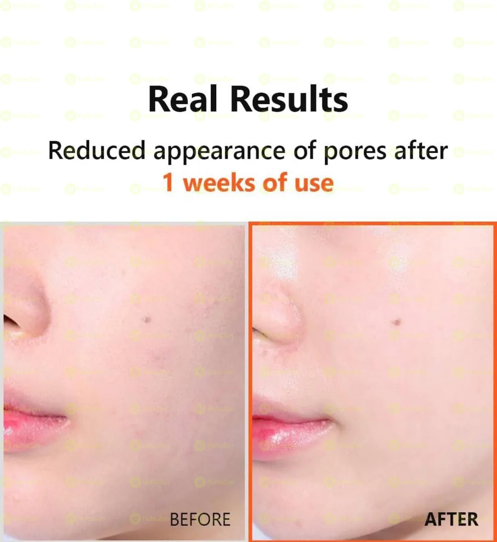 Isntree Hyper Niacinamide 20 Serum