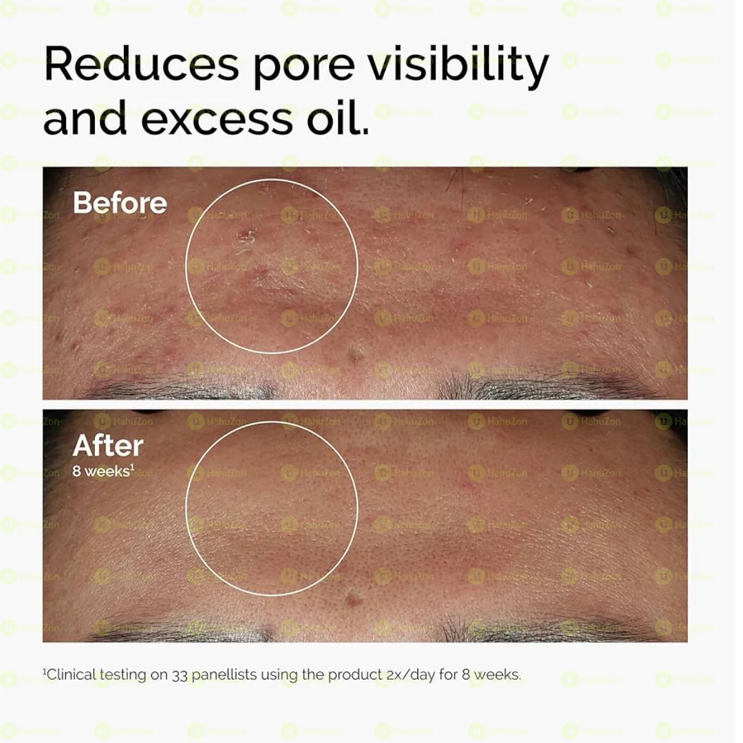 The Ordinary Niacinamide 10% + Zinc 1% Smoothing Serum