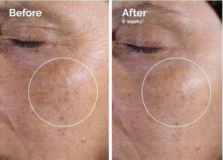 The ordinary glycolic acid 7 percent