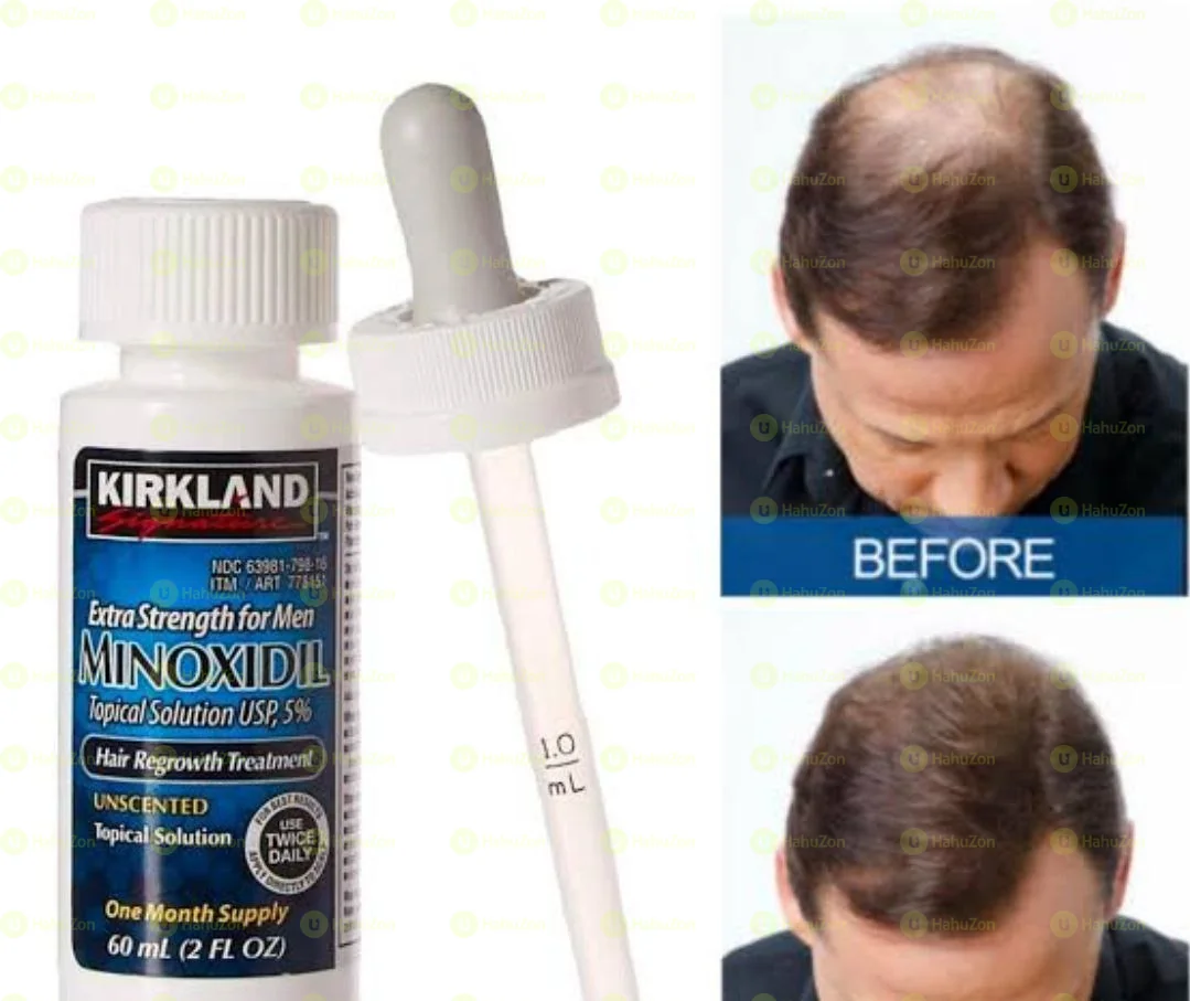 Minoxidil Extra Strength