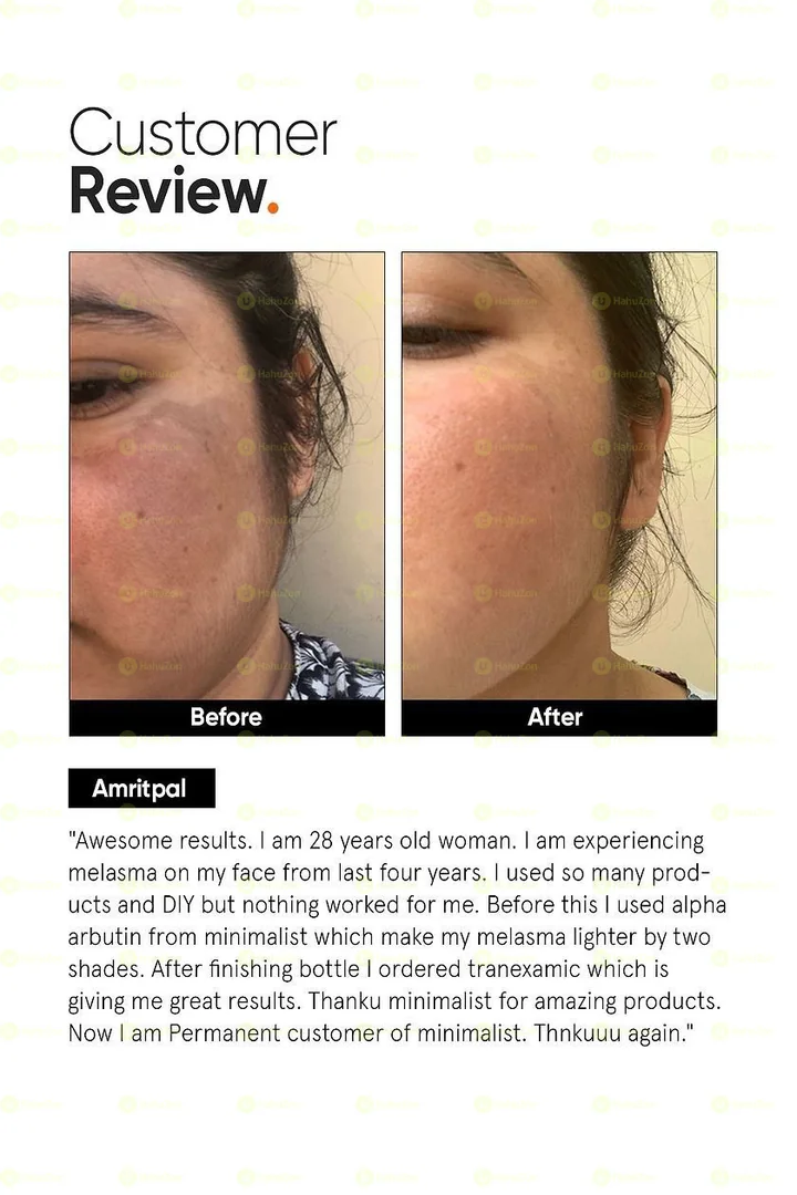 Minimalist Tranexamic 3% Face Serum