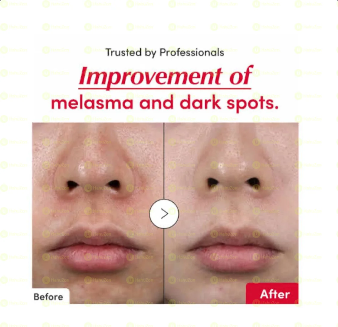 EQUALBERRY–VITAMIN ILLUMINATING SERUM