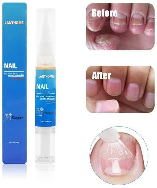 Lanthome Nail Repair