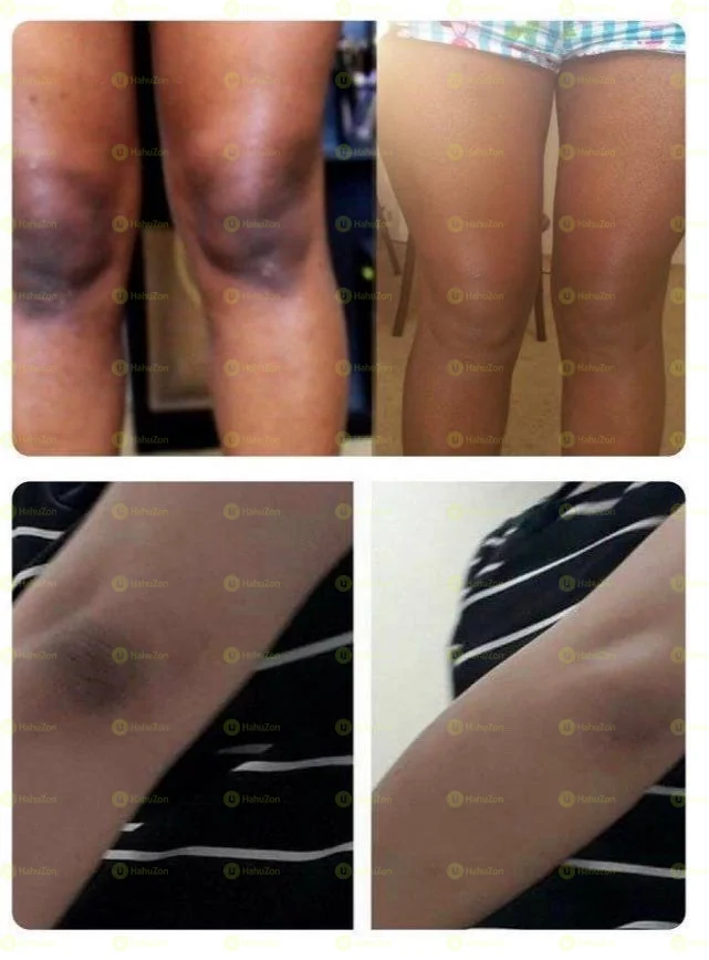 Bio-Oil Skincare Oil