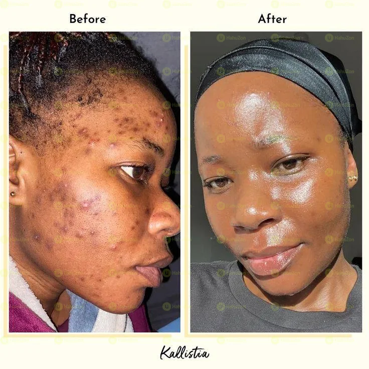 Bio-Oil Skincare Oil