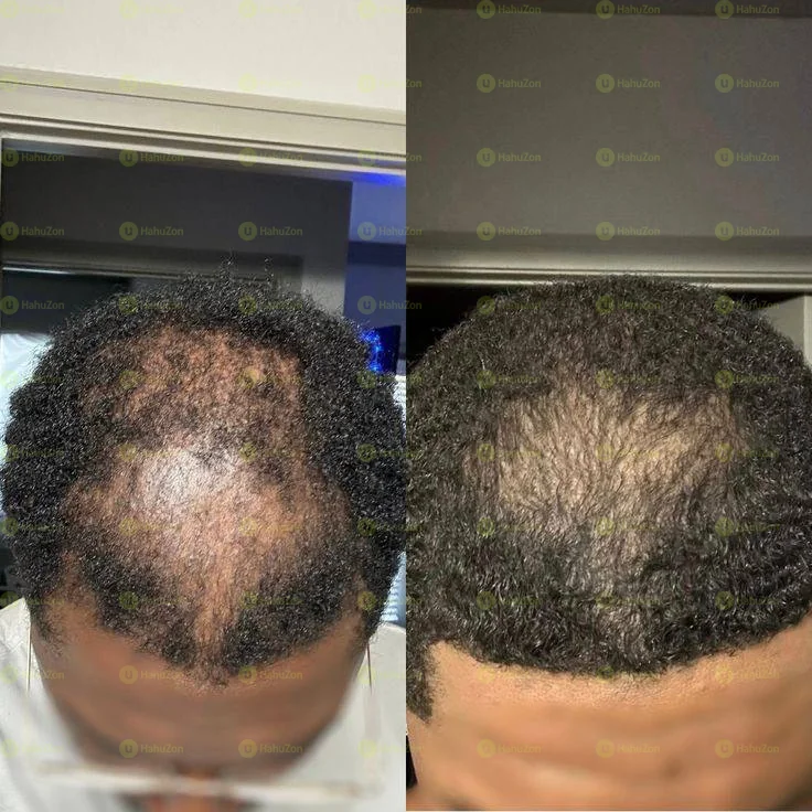 Original Wild Growth Hair Oil