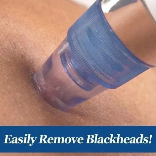 Facial Vacuum Blackhead & Acne pore Skin Cleaner